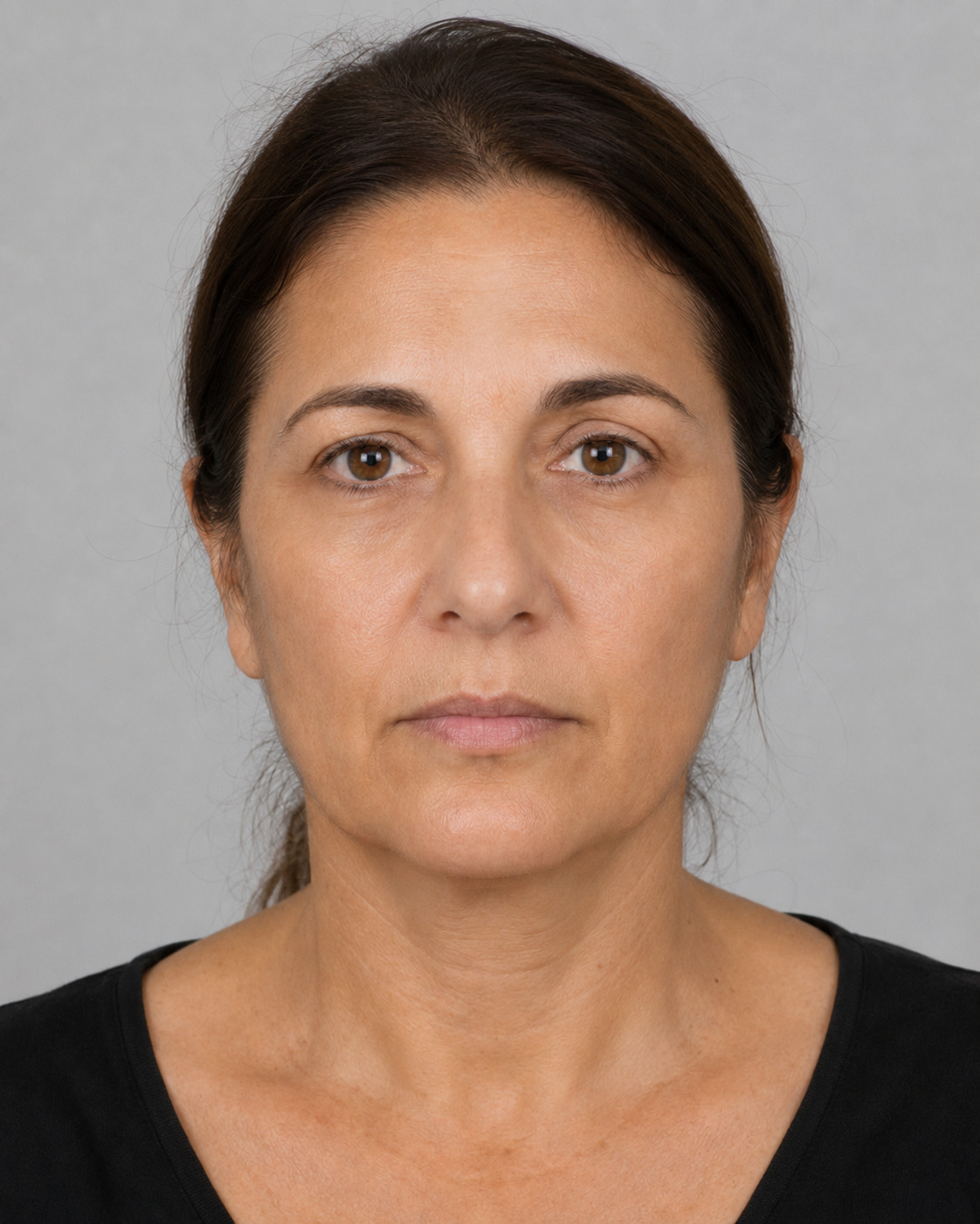 Dopo - Chirurgia dermatologica