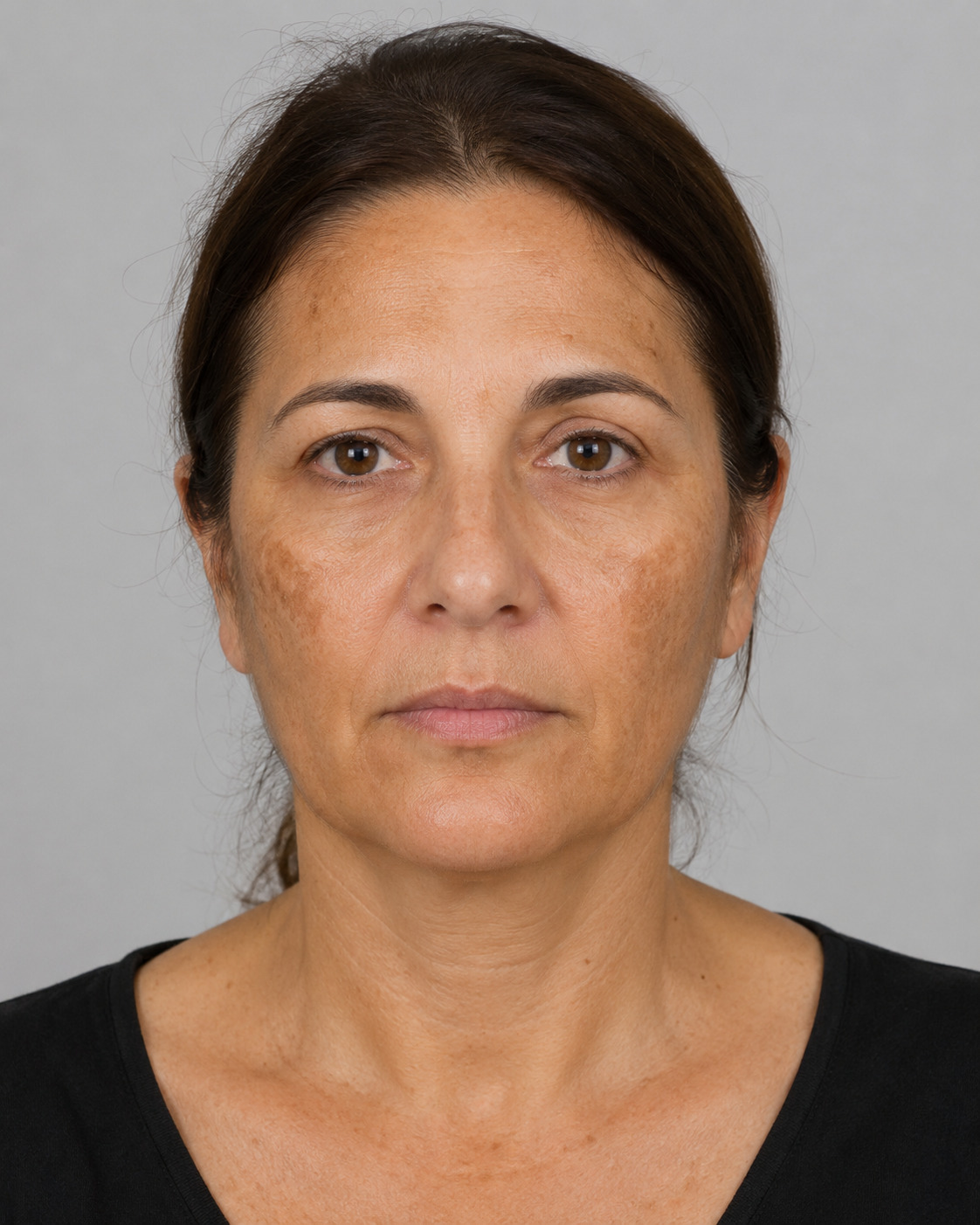 Prima - Chirurgia dermatologica
